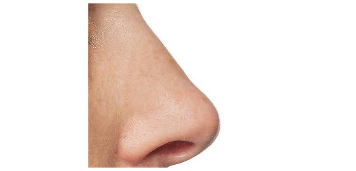 Nase
