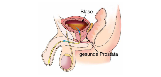 Prostata